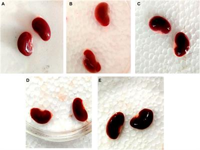 Renal mitochondrial restoration by gymnemic acid in gentamicin-mediated experimental nephrotoxicity: evidence from serum, kidney and histopathological alterations